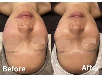 サロン デ ミロ(Salon de Miro)/BeforeAfter多数！ブログへGO♪
