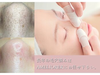 アメリオレ 三鷹店(AMELIORER)/症例写真