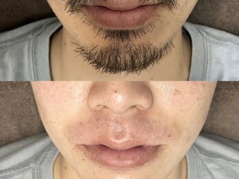 ラニブロウ(Lani brow)/メンズフェイシャルワックス