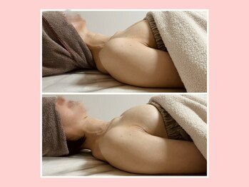 イッツソウ(It's so...)/ビフォーアフター写真