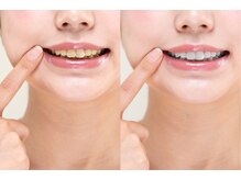 ホワイトニングサロン 一宮