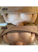 美人バスト 浦和店/【バストアップ★育乳】症例