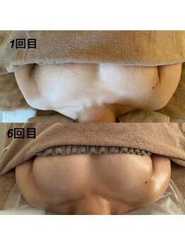 美人バスト 浦和店/【バストアップ★育乳】症例