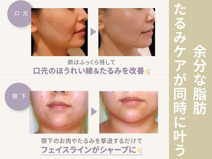 テセラ(Tethere)の写真