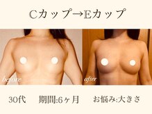 オリーブ 金沢(Olive)の雰囲気（バストアップ専門店の高い知識とハンド技術で理想のバストへ♪）