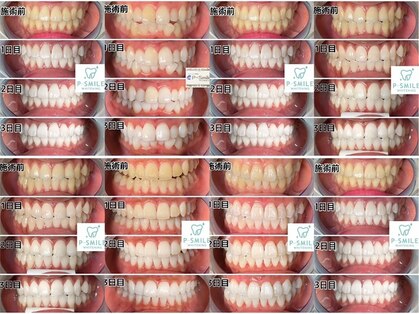 ホワイトベース(White Base)の写真