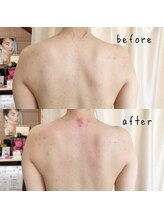 ココフルール(Cocofleur)/インディバ＆アロマのセット