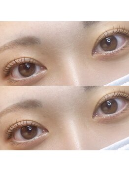 ピノ(pino)/パッチリ二重/CLカール