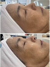 アール 多治見店(#arl)/ゾンビパック