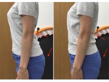 のなか整体院/ビフォーアフター