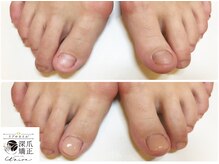 トイロ(toiro)/素足でサンダルを履きたい！