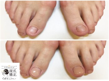 トイロ(toiro)/素足でサンダルを履きたい！