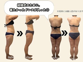 エルソル(elsol)/