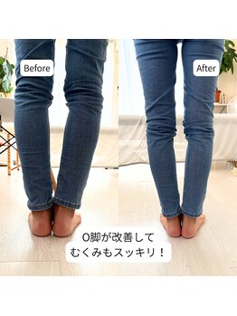 はやと整体院/40代女性(O脚・むくみ)