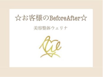 ウェリナ 一宮院/7.【小顔矯正before→after】
