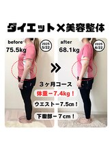 ヴレ 福岡店(Vraie)/リバウンドなし