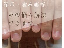 ビビネイル(BIBI Nail)の雰囲気（【本格育爪】深爪や自爪コンプレックスの方は是非ご相談ください）