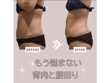 ソワン 小岩店(Soin)/40代　お腹