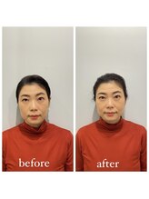 美容整体プラスフィール 恵比寿本店/小顔・リフトアップ