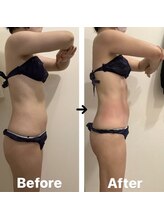 ワイグレイス(Y.GRACE)/ヴィーナスディーバ（4D痩身）