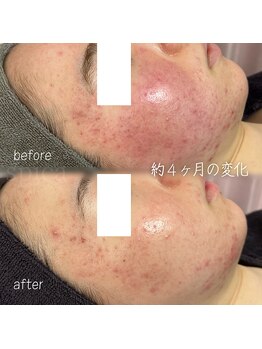 スピカ(Spica)/約4ヶ月の変化