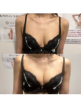 ジュエルリング(Jewel Ring)/バストアップ【恵比寿代官山】