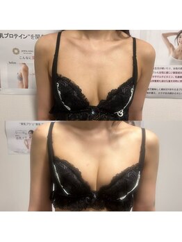 ジュエルリング(Jewel Ring)/バストアップ【恵比寿代官山】