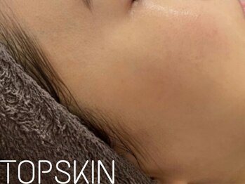 トップスキン 表参道(TOPSKIN)/肌質改善の専門スタッフが担当