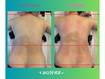 エスナ/リゾート旅行前にもオススメ♪