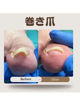 巻き爪補正店 那覇店/