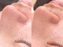 エイミーアイラッシュ 川崎(Aimey eyelash)/【フェイシャルワックス】小鼻