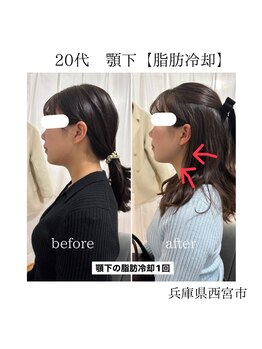 ルーチェエムベルシック(Luce.MBelChic)/フェイスラインのお悩みに