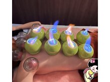 足技の匠の雰囲気（カッピングで疲れ解消、免疫力アップ）