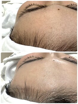 イスリー(ithree.)/くすみ肌卒業　担当ikuko