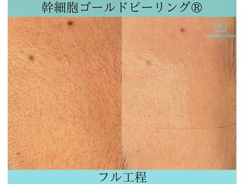 リメイク 広尾(REMAKE)/