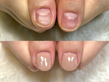 グレースレディ 大阪店/(深爪/長さだし/フィルイン)