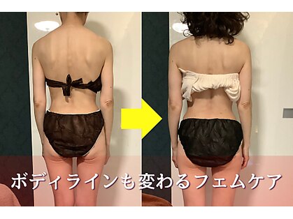 パラアモール(Paraamor)の写真