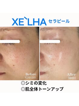 シュ シュ(chou chou)/【セラピール】