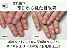 深爪矯正専門サロン LeSoar 【ルソア】【4/8 NEW OPEN(予定)】