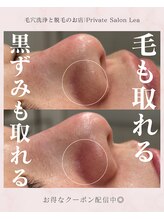 レア(Lea)/毛も取れる!!毛穴洗浄＊