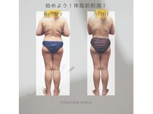 ヨサパーク アイリスリリィ 麻布十番店(YOSA PARK Irislily)の雰囲気(脂肪を燃焼でセル脂肪を柔らかく驚きの結果◎見た目から変化!)