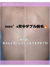 ジョエルワックス 沖縄糸満店(JOELLE WAX)/メンズ背中ダブル脱毛