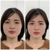 シェリ リハ・シェリ
