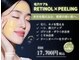 ディンプル(Dimple)の写真