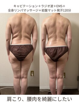 アフター(AFTER)の写真/完全都度払い | 無理な勧誘なし