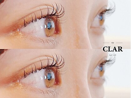 クラル(CLAR)の写真