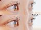 クラル(CLAR)の写真