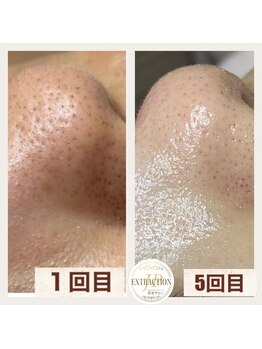 ラディア(Radia)/