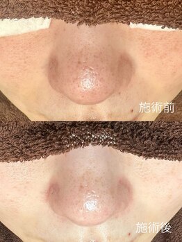 エクラ バイ シャンリィ(eclat by shanLy)/トーンアップ実感!