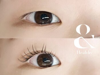 アイアンドネイル ブライト(bright)/＆healthy